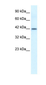 ESR2 / ER Beta Antibody - ESR2 / ER-Beta antibody Western blot of HepG2 cell lysate. This image was taken for the unconjugated form of this product. Other forms have not been tested.