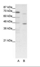 ESR2 / ER Beta Antibody - A: Marker, B: HepG2 Cell Lysate.  This image was taken for the unconjugated form of this product. Other forms have not been tested.