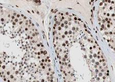ESR2 / ER Beta Antibody - 1:100 staining human Testis tissue by IHC-P. The tissue was formaldehyde fixed and a heat mediated antigen retrieval step in citrate buffer was performed. The tissue was then blocked and incubated with the antibody for 1.5 hours at 22°C. An HRP conjugated goat anti-rabbit antibody was used as the secondary.