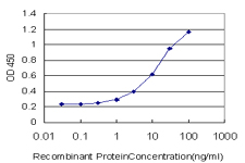 ESR2 / ER Beta Antibody - Detection limit for recombinant GST tagged ESR2 is approximately 0.3 ng/ml as a capture antibody.