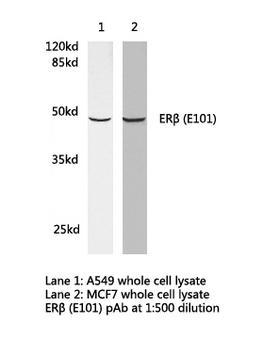 ESR2 / ER Beta Antibody - Western blot of ER (E101) pAb in extracts from A549, MCF7 and SP20 cells.