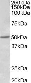 ESR2 / ER Beta Antibody - ESR2 antibody (1 ug/ml) staining of Human Placenta lysate (35 ug protein in RIPA buffer). Primary incubation was 1 hour. Detected by chemiluminescence.