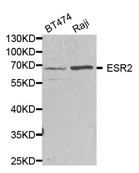 ESR2 / ER Beta Antibody - Western blot analysis of extracts of various cell lines, using ESR2 antibody.