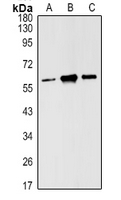 ESR2 / ER Beta Antibody - Western blot analysis of Estrogen Receptor beta expression in MCF7 (A), mouse ovary(B), rat ovary (C) whole cell lysates.