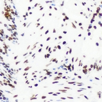 ESR2 / ER Beta Antibody - Immunohistochemical analysis of Estrogen Receptor beta staining in mouse lung formalin fixed paraffin embedded tissue section. The section was pre-treated using heat mediated antigen retrieval with sodium citrate buffer (pH 6.0). The section was then incubated with the antibody at room temperature and detected using an HRP conjugated compact polymer system. DAB was used as the chromogen. The section was then counterstained with haematoxylin and mounted with DPX.