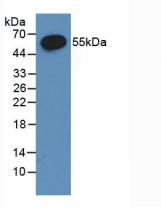 ESR2 / ER Beta Antibody - Western Blot; Sample: Recombinant ERb, Rat.