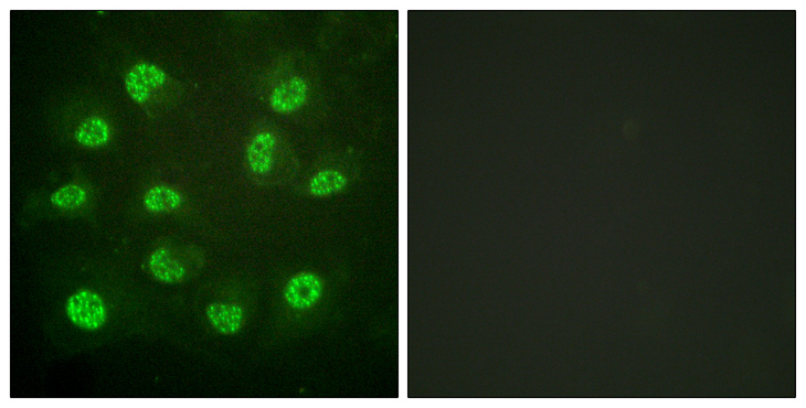 ESR2 / ER Beta Antibody - Immunofluorescence analysis of HUVEC cells, using Estrogen Receptor-beta (Phospho-Ser105) Antibody. The picture on the right is blocked with the phospho peptide.