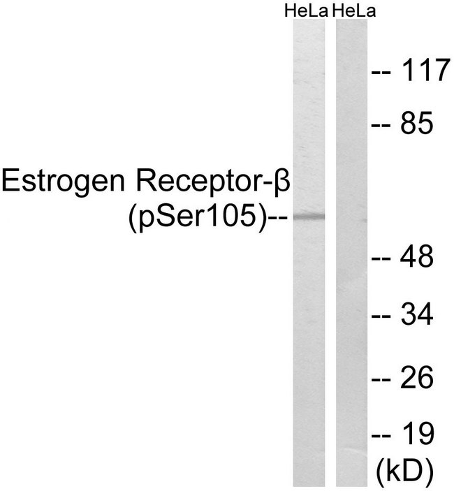 ESR2 / ER Beta Antibody - Western blot analysis of lysates from HeLa cells, using Estrogen Receptor-beta (Phospho-Ser105) Antibody. The lane on the right is blocked with the phospho peptide.
