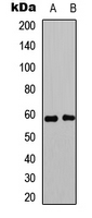 ESR2 / ER Beta Antibody - Western blot analysis of Estrogen Receptor beta (pS105) expression in MCF7 (A); HeLa (B) whole cell lysates.