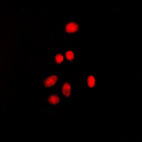 ESR2 / ER Beta Antibody - Immunofluorescent analysis of Estrogen Receptor beta (pS105) staining in MCF7 cells. Formalin-fixed cells were permeabilized with 0.1% Triton X-100 in TBS for 5-10 minutes and blocked with 3% BSA-PBS for 30 minutes at room temperature. Cells were probed with the primary antibody in 3% BSA-PBS and incubated overnight at 4 ??C in a humidified chamber. Cells were washed with PBST and incubated with a DyLight 594-conjugated secondary antibody (red) in PBS at room temperature in the dark. DAPI was used to stain the cell nuclei (blue).