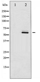 ESR2 / ER Beta Antibody - Western blot of Estrogen Receptor- beta phosphorylation expression in HepG2 whole cell lysates,The lane on the left is treated with the antigen-specific peptide.