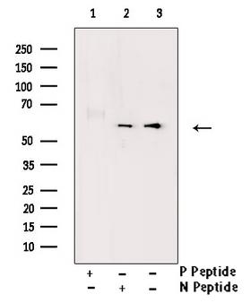 ESR2 / ER Beta Antibody - Western blot analysis of Phospho-Estrogen Receptor beta (Ser105) antibody expression in HepG2 cells lysates. The lane on the right is treated with the antigen-specific peptide.