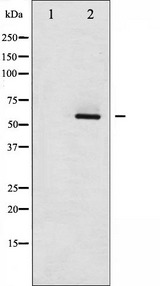 ESR2 / ER Beta Antibody - Western blot analysis of Estrogen Receptor-beta phosphorylation expression in HepG2 whole cells lysates. The lane on the left is treated with the antigen-specific peptide.