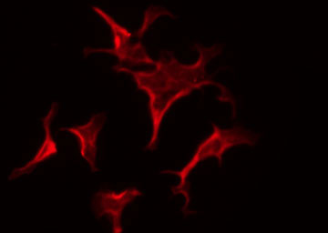 ESR2 / ER Beta Antibody - Staining HepG2 cells by IF/ICC. The samples were fixed with PFA and permeabilized in 0.1% Triton X-100, then blocked in 10% serum for 45 min at 25°C. The primary antibody was diluted at 1:200 and incubated with the sample for 1 hour at 37°C. An Alexa Fluor 594 conjugated goat anti-rabbit IgG (H+L) Ab, diluted at 1/600, was used as the secondary antibody.