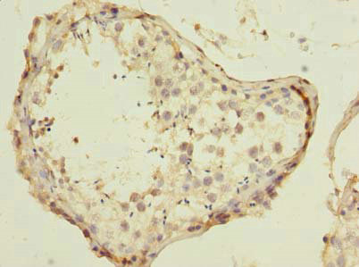 ESRG Antibody - Immunohistochemistry of paraffin-embedded human testis at dilution of 1:100