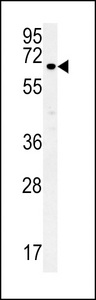ESRP1 / RBM35A Antibody - ESRP1 Antibody western blot of MCF-7 cell line lysates (35 ug/lane). The ESRP1 antibody detected the ESRP1 protein (arrow).