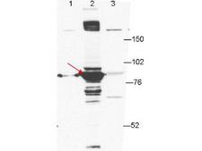 ESRP1 / RBM35A Antibody - Anti-ESRP-1 Antibody - Western Blot. Anti-ESRP-1 by western blot shows detection of ESRP-1 in transfected 293T cell extracts (lane 2, arrowhead). Lanes 1 and 3 contain GFP-transfected- and ESRP2-transfected 293T cell lysates, respectively. Briefly, each lane contains approximately 5 ug of lysate. Primary antibody was used at a 1:1000 dilution in PBS-T plus milk, and reacted for 1hr at room temperature. The membrane was washed and reacted with a 1:10000 dilution of an anti-mouse ECL antibody for 1hr at room temperature. Molecular weight estimation was made by comparison to prestained MW markers.