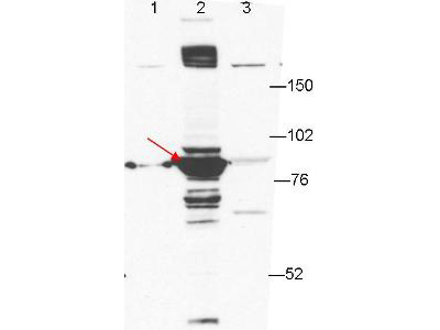 ESRP1 / RBM35A Antibody - Anti-ESRP-1 by western blot shows detection of ESRP-1 in transfected 293T cell extracts (lane 2, arrowhead). Lanes 1 and 3 contain GFP-transfected- and ESRP2-transfected 293T cell lysates, respectively. Briefly, each lane contains approximately 5 µg of lysate. Primary antibody was used at a 1:1000 dilution in PBS-T plus milk, and reacted for 1hr at room temperature. The membrane was washed and reacted with a 1:10,000 dilution of an anti-mouse ECL antibody for 1hr at room temperature. Molecular weight estimation was made by comparison to prestained MW markers.