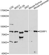 ESRP1 / RBM35A Antibody - Western blot analysis of extracts of various cell lines, using ESRP1 antibody at 1:1000 dilution. The secondary antibody used was an HRP Goat Anti-Rabbit IgG (H+L) at 1:10000 dilution. Lysates were loaded 25ug per lane and 3% nonfat dry milk in TBST was used for blocking. An ECL Kit was used for detection and the exposure time was 30s.
