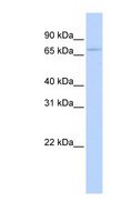 ESRP2 / RBM35B Antibody - ESRP2 / RBM35B antibody Western blot of HeLa lysate. This image was taken for the unconjugated form of this product. Other forms have not been tested.