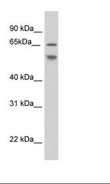ESRP2 / RBM35B Antibody - NIH 3T3 Cell Lysate.  This image was taken for the unconjugated form of this product. Other forms have not been tested.