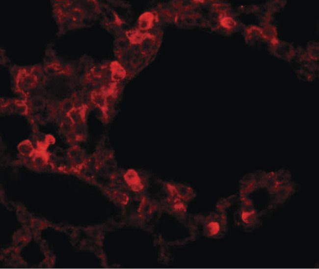 ESRP2 / RBM35B Antibody - Immunofluorescence of RBM35B in human lung tissue cells with RBM35B antibody at 20 ug/ml.