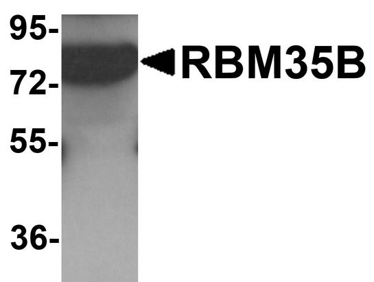 ESRP2 / RBM35B Antibody - Western blot analysis of RBM35B in human lung tissue lysate with RBM35B antibody at 1 ug/ml.