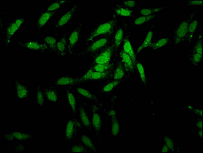 ESRP2 / RBM35B Antibody - Immunofluorescence staining of Hela cells at a dilution of 1:100, counter-stained with DAPI. The cells were fixed in 4% formaldehyde, permeabilized using 0.2% Triton X-100 and blocked in 10% normal Goat Serum. The cells were then incubated with the antibody overnight at 4°C.The secondary antibody was Alexa Fluor 488-congugated AffiniPure Goat Anti-Rabbit IgG (H+L) .