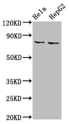 ESRP2 / RBM35B Antibody - Positive Western Blot detected in Hela whole cell lysate, HepG2 whole cell lysate. All lanes: ESRP2 antibody at 6 µg/ml Secondary Goat polyclonal to rabbit IgG at 1/50000 dilution. Predicted band size: 79, 78 KDa. Observed band size: 79 KDa