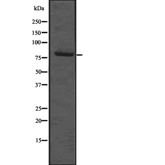 ESRP2 / RBM35B Antibody - Western blot analysis of RBM35B expression in HeLa cells lysate. The lane on the left is treated with the antigen-specific peptide.
