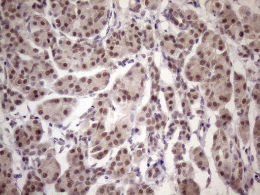 ESRRA / ERR Alpha Antibody - Immunohistochemical staining of paraffin-embedded Human pancreas tissue within the normal limits using anti-ESRRA mouse monoclonal antibody. (Heat-induced epitope retrieval by 1mM EDTA in 10mM Tris buffer. (pH8.5) at 120 oC for 3 min. (1:150)
