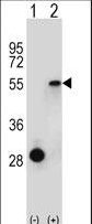 ESRRA / ERR Alpha Antibody - Western blot of ESRRA (arrow) using rabbit polyclonal ESRRA Antibody. 293 cell lysates (2 ug/lane) either nontransfected (Lane 1) or transiently transfected (Lane 2) with the ESRRA gene.