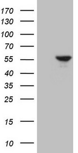 ESRRA / ERR Alpha Antibody - HEK293T cells were transfected with the pCMV6-ENTRY control. (Left lane) or pCMV6-ENTRY ESRRA. (Right lane) cDNA for 48 hrs and lysed. Equivalent amounts of cell lysates. (5 ug per lane) were separated by SDS-PAGE and immunoblotted with anti-ESRRA. (1:2000)