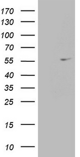 ESRRA / ERR Alpha Antibody - HEK293T cells were transfected with the pCMV6-ENTRY control. (Left lane) or pCMV6-ENTRY ESRRA. (Right lane) cDNA for 48 hrs and lysed. Equivalent amounts of cell lysates. (5 ug per lane) were separated by SDS-PAGE and immunoblotted with anti-ESRRA. (1:200)(1:500)