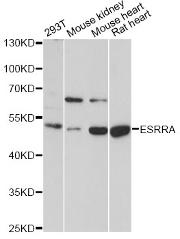 ESRRA / ERR Alpha Antibody - Western blot analysis of extracts of various cell lines, using ESRRA antibody at 1:1000 dilution. The secondary antibody used was an HRP Goat Anti-Rabbit IgG (H+L) at 1:10000 dilution. Lysates were loaded 25ug per lane and 3% nonfat dry milk in TBST was used for blocking. An ECL Kit was used for detection and the exposure time was 30s.