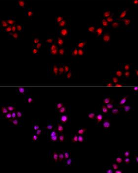 ESRRA / ERR Alpha Antibody - Immunofluorescence analysis of HeLa cells using ESRRA Polyclonal Antibody at dilution of 1:100.Blue: DAPI for nuclear staining.