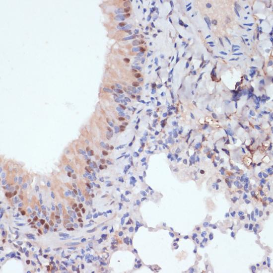 ESRRA / ERR Alpha Antibody - Immunohistochemistry of paraffin-embedded Mouse lung using ESRRA Polyclonal Antibody at dilution of 1:200 (40x lens).