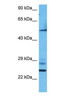 ESRRA / ERR Alpha Antibody - Western blot of ERR1 Antibody with human 786-0 Whole Cell lysate.  This image was taken for the unconjugated form of this product. Other forms have not been tested.