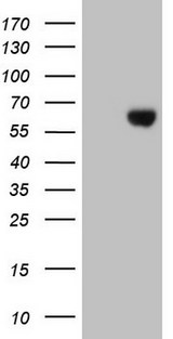ESRRB / ERR Beta Antibody - HEK293T cells were transfected with the pCMV6-ENTRY control. (Left lane) or pCMV6-ENTRY ESRRB. (Right lane) cDNA for 48 hrs and lysed. Equivalent amounts of cell lysates. (5 ug per lane) were separated by SDS-PAGE and immunoblotted with anti-ESRRB. (1:500)