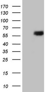 ESRRB / ERR Beta Antibody - HEK293T cells were transfected with the pCMV6-ENTRY control. (Left lane) or pCMV6-ENTRY ESRRB. (Right lane) cDNA for 48 hrs and lysed. Equivalent amounts of cell lysates. (5 ug per lane) were separated by SDS-PAGE and immunoblotted with anti-ESRRB.
