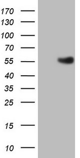 ESRRB / ERR Beta Antibody - HEK293T cells were transfected with the pCMV6-ENTRY control (Left lane) or pCMV6-ENTRY ESRRB (Right lane) cDNA for 48 hrs and lysed. Equivalent amounts of cell lysates (5 ug per lane) were separated by SDS-PAGE and immunoblotted with anti-ESRRB.