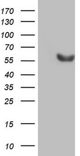 ESRRB / ERR Beta Antibody - HEK293T cells were transfected with the pCMV6-ENTRY control. (Left lane) or pCMV6-ENTRY ESRRB. (Right lane) cDNA for 48 hrs and lysed. Equivalent amounts of cell lysates. (5 ug per lane) were separated by SDS-PAGE and immunoblotted with anti-ESRRB.