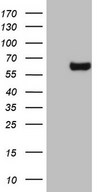 ESRRB / ERR Beta Antibody - HEK293T cells were transfected with the pCMV6-ENTRY control (Left lane) or pCMV6-ENTRY ESRRB (Right lane) cDNA for 48 hrs and lysed. Equivalent amounts of cell lysates (5 ug per lane) were separated by SDS-PAGE and immunoblotted with anti-ESRRB.