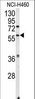 ESRRB / ERR Beta Antibody - Western blot of ESRRB Antibody in NCI-H460 cell line lysates (35 ug/lane). ESRRB (arrow) was detected using the purified antibody.