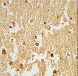 ESRRB / ERR Beta Antibody - Formalin-fixed and paraffin-embedded human brain tissue reacted with ESRRB Antibody , which was peroxidase-conjugated to the secondary antibody, followed by DAB staining. This data demonstrates the use of this antibody for immunohistochemistry; clinical relevance has not been evaluated.