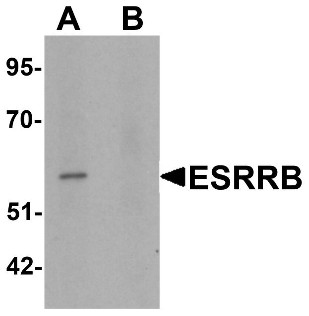 ESRRB / ERR Beta Antibody - Western blot analysis of ESRRB in human heart tissue lysate with ESRRB antibody at 1 ug/ml in (A) the absence and (B) the presence of blocking peptide.