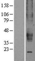 ESRRB / ERR Beta Protein - Western validation with an anti-DDK antibody * L: Control HEK293 lysate R: Over-expression lysate