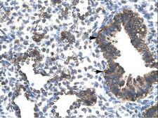 ESRRG / ERR Gamma Antibody - ESRRG / ERR3 antibody ARP31655_T100-NP_996318-ESRRG (estrogen-related receptor gamma) Antibody was used in IHC to stain formalin-fixed, paraffin-embedded human lung.  This image was taken for the unconjugated form of this product. Other forms have not been tested.