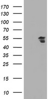 ESRRG / ERR Gamma Antibody - HEK293T cells were transfected with the pCMV6-ENTRY control (Left lane) or pCMV6-ENTRY ESRRG (Right lane) cDNA for 48 hrs and lysed. Equivalent amounts of cell lysates (5 ug per lane) were separated by SDS-PAGE and immunoblotted with anti-ESRRG.