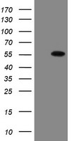 ESRRG / ERR Gamma Antibody - HEK293T cells were transfected with the pCMV6-ENTRY control (Left lane) or pCMV6-ENTRY ESRRG (Right lane) cDNA for 48 hrs and lysed. Equivalent amounts of cell lysates (5 ug per lane) were separated by SDS-PAGE and immunoblotted with anti-ESRRG.